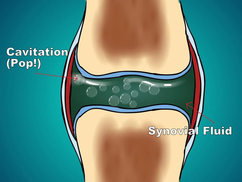 cavitation