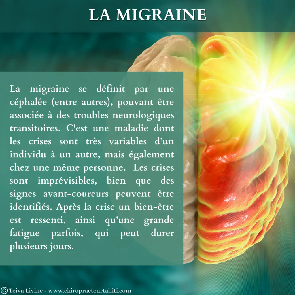 La migraine
