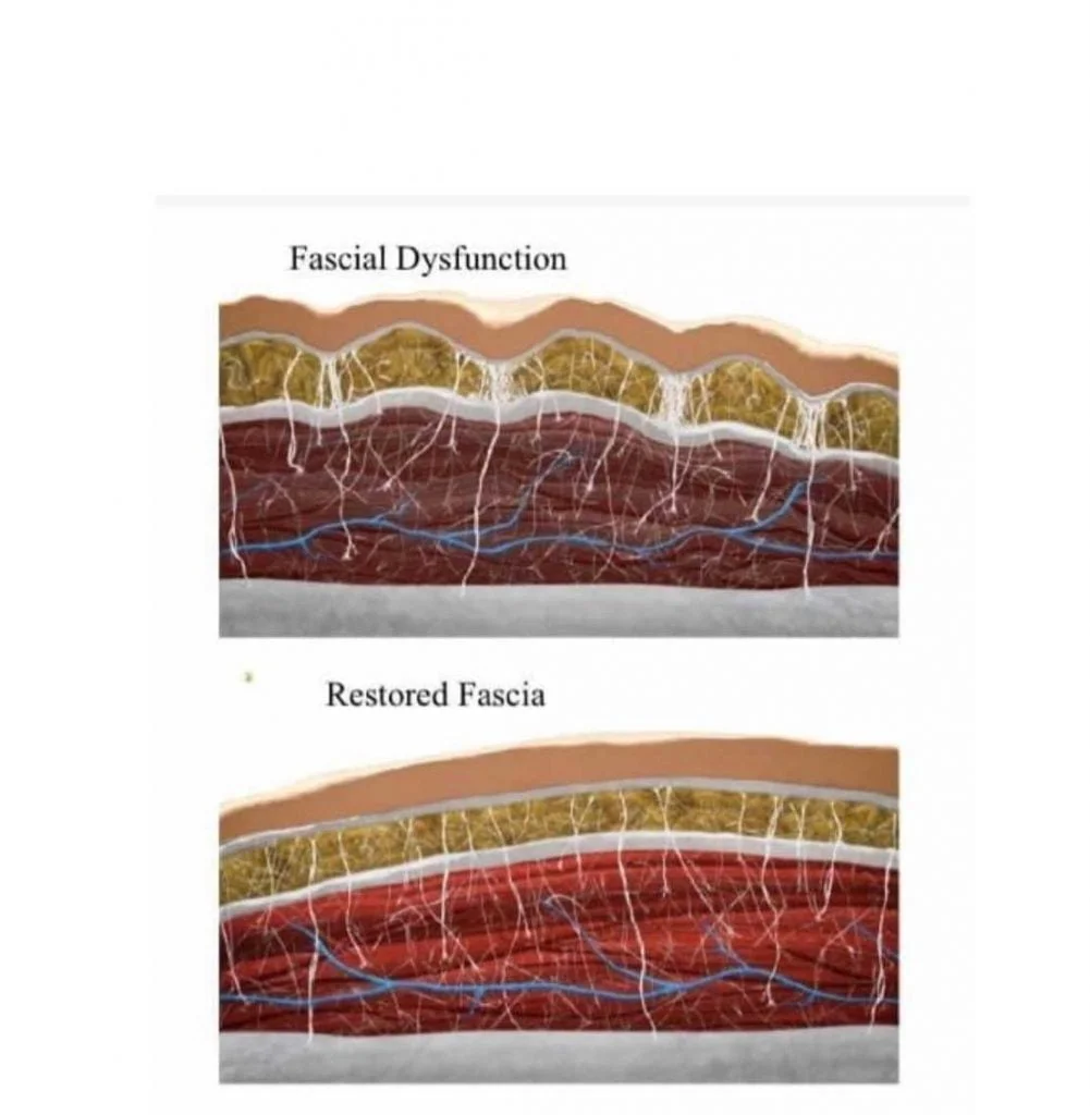 Fascia 2
