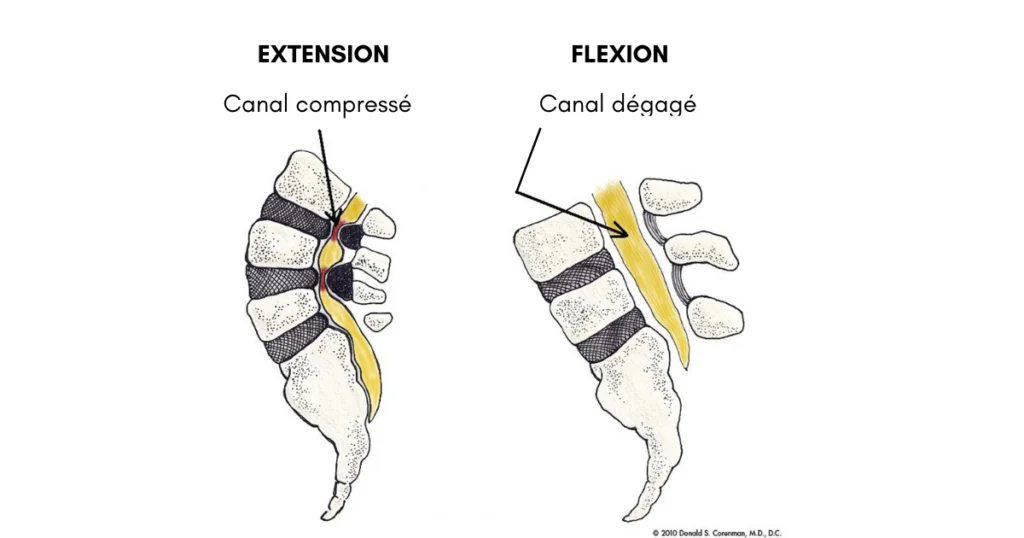 Table Flexion-distraction