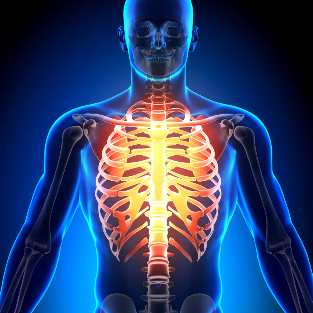 subluxation fréquente