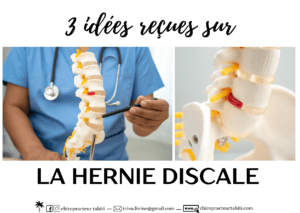 3 idées reçues sur la hernie discale